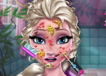 Ice Queen Skin Doctor game screenshot