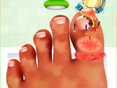Küünte Kirurgia Mäng mängu ekraanipilt